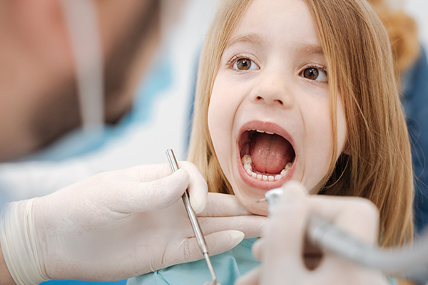 Composite Fillings for Kids