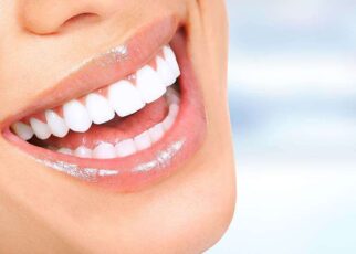 laser teeth whitening