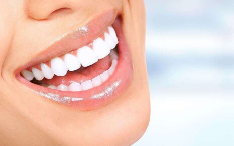 laser teeth whitening