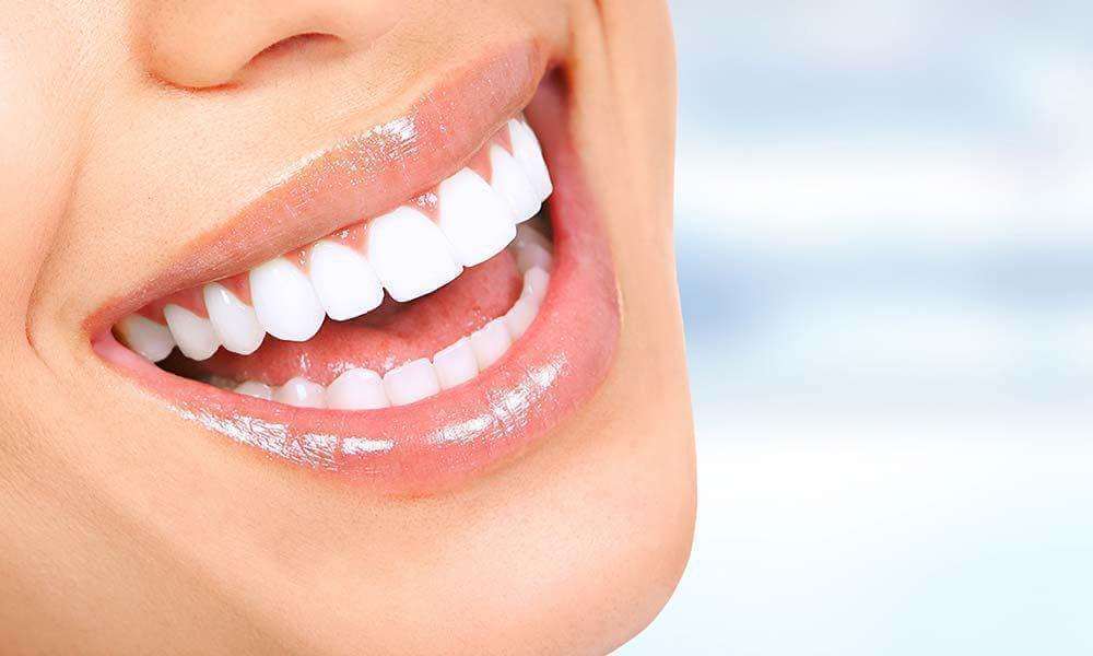 laser teeth whitening