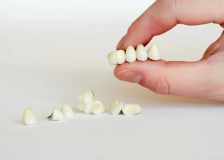 Dental Crowns