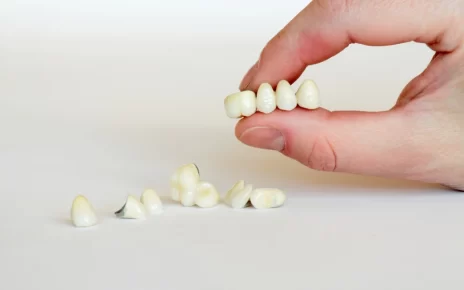 Dental Crowns