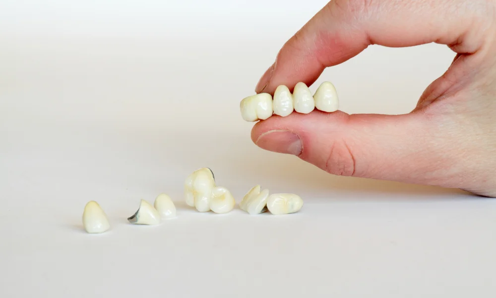 Dental Crowns