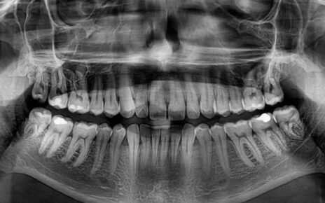 Dental X Rays