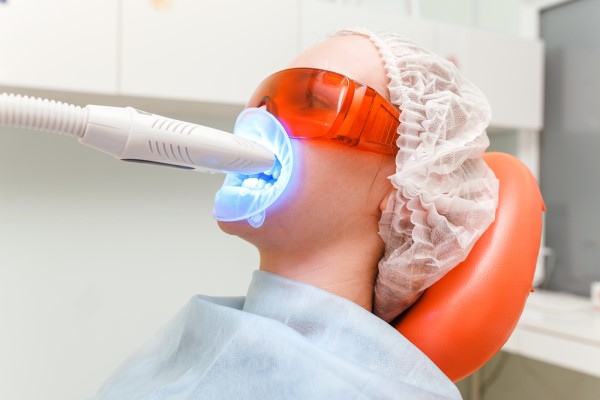 laser teeth whitening